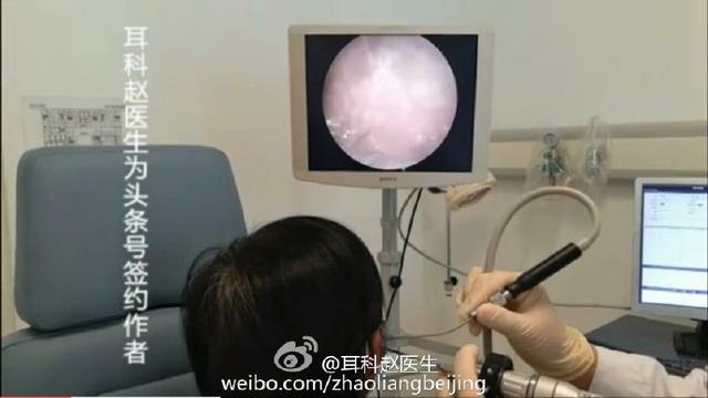 为什么那多么人喜欢看耳科赵医生发的掏耳朵视频？